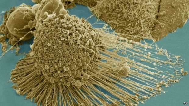 Pesquisa pode ajudar a desenvolver novos tratamentos contra o cncer. (Foto: BBC)