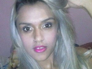 Millyana de Souza, de 20 anos, ficou um ms internada
