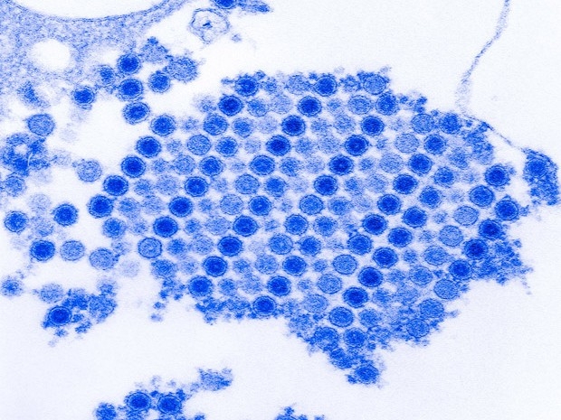 Vrus chikungunya foi isolado a partir de amostras humanas por laboratrio do Instituto Carlos Chagas, da Fiocruz Paran