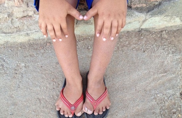 Victor Soares, de 8 anos, sofre de polidactilia e tem 26 dedos (Foto: Humberta Carvalho/G1)