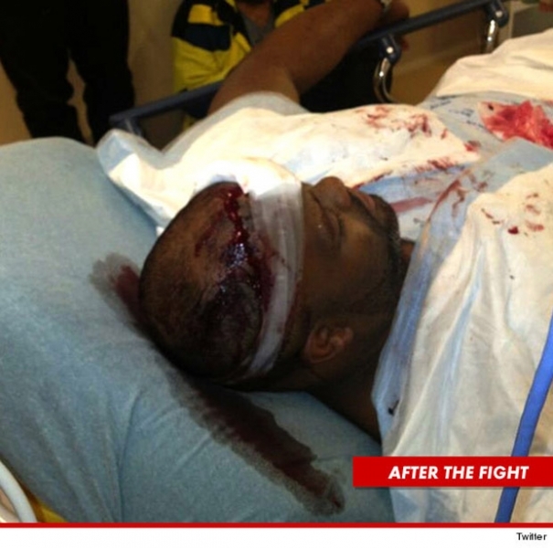 Segurana de Chris Brown machucado aps briga (Foto: Twitter / Reproduo)