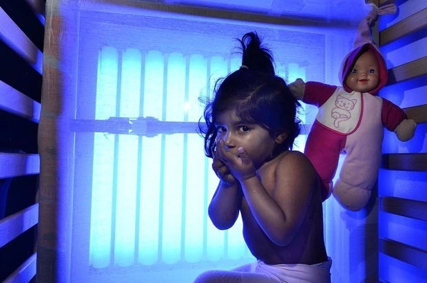 A inglesa Areesha Shehzad, de dois anos, que passa 12 horas por dia em cama com painis que emitem raios UV em tratament