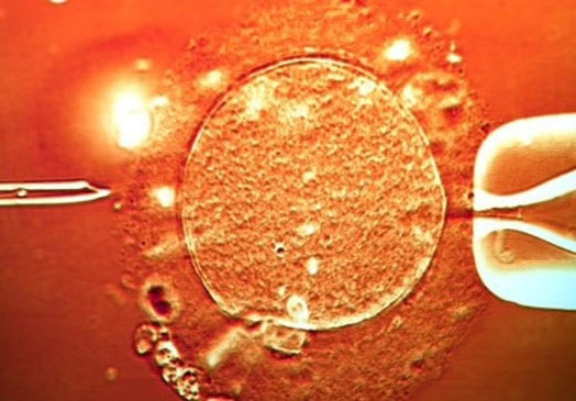 vulo recebe espermatozoides para gerar futuro embrio 