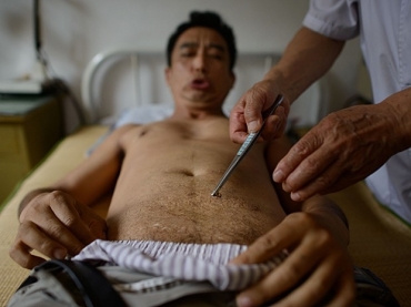 Homem faz careta antes de receber picada de abelha administrada por mdico da medicina tradicional chinesa em clnica de