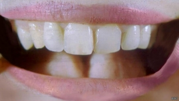 Estudo chins testou o uso de urina para tentar recriar dentes por meio de clulas-tronco. (Foto: BBC)