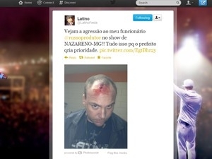 Cantor postou no Twitter foto do produtor agredido (Foto: Reproduo Twitter)