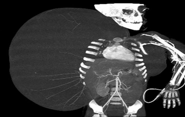 Raio-X mostra o tamanho do tumor de 15 kg