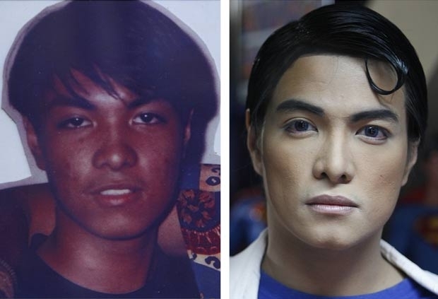 Filipino Herbert Chavez, de 35 anos, realizou vrias cirurgias plsticas desde 1995.