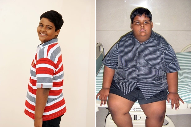 Ksithijj Jingder aos 11 anos de idade, com 69 quilos, e em 2009, antes de passar por cirurgia baritrica, quando o india