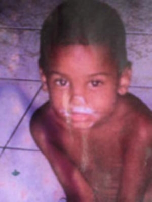 Vinicius, de 6 anos, brincava na rua quando foi atingido